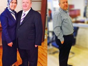 Tüp Mide Ameliyatı İle Hem Şekeri Hem De Hipertansiyonu Yendi