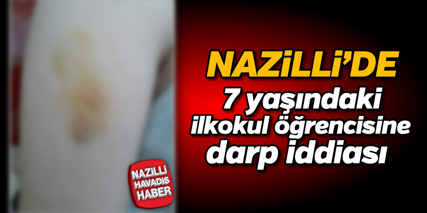 Nazilli'de 7 yaşındaki ilkokul öğrencisine darp iddiası