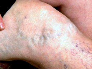 Varis Korkulu Rüyanız Olmak Zorunda Değil