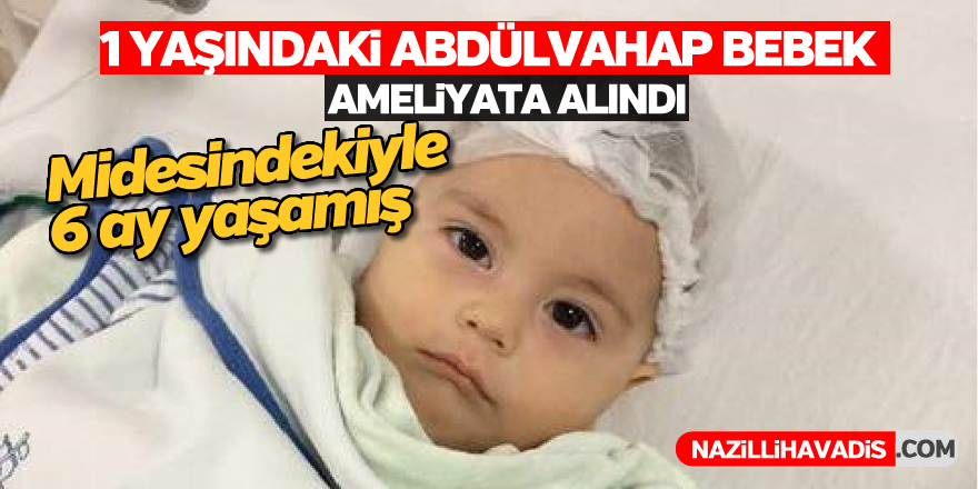 1 yaşındaki Abdülvahap bebek ameliyata alındı