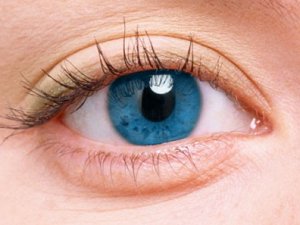 Göz Hastalığı Göz Rengini Değiştiriyor