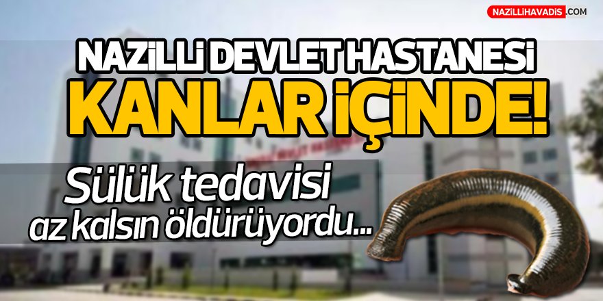 Sülük tedavisi az kalsın öldürüyordu!