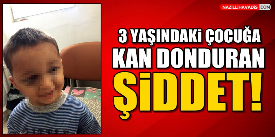 3 yaşındaki çocuğa kan donduran şiddet!