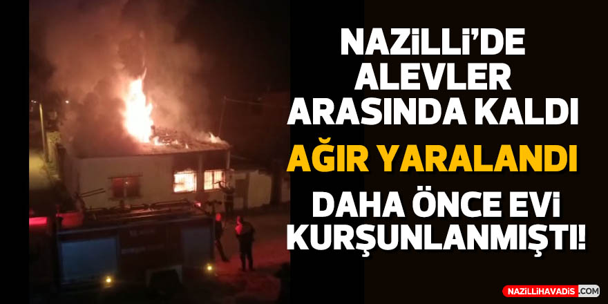 Nazilli'de evde çıkan yangında 1 kişi ağır yaralandı