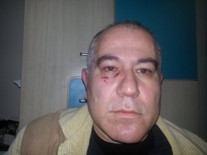 Gazeteci Töz’ü Darp Eden Saldırganlar Yakalandı
