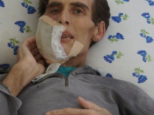 Amansız Hastalığa Yenik Düşen Boykan Ailesi’nin Dramı