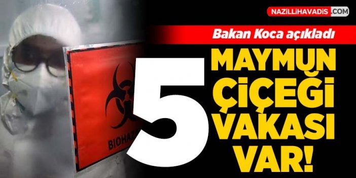 Bakan Koca açıkladı! Türkiye'de maymun çiçeği vakası yükseldi