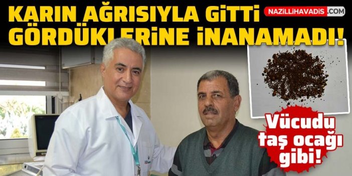 Karın ağrısıyla hastaneye gitti! Gördükleri karşısında şok geçirdi