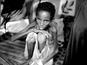 925 Milyon İnsan Aç, 500 Milyon İnsan Obez