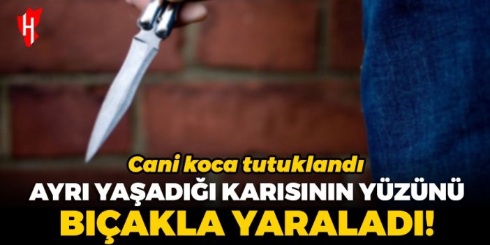 Ayrı yaşadığı karısının yüzünü bıçakla yaraladı! Cani koca tutuklandı