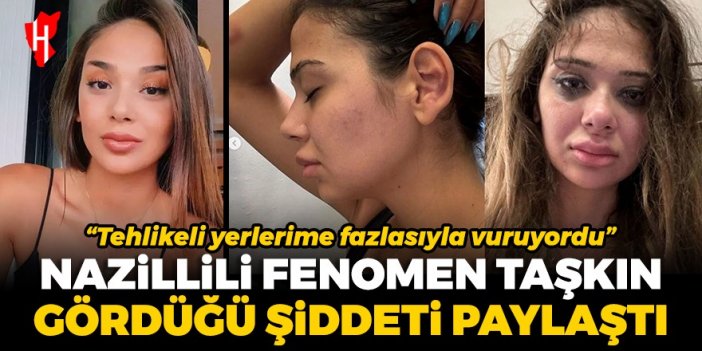 Nazillili fenomen Merve Taşkın sevgilisinden gördüğü şiddeti paylaştı