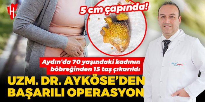 Uzm. Dr. Ayköse’den başarılı operasyon: Aydın’da 70 yaşındaki kadının böbreğinden 15 taş çıkarıldı