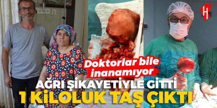 Böylesini gören var mı? Genç kadının mesanesinden 1 kiloluk taş çıktı