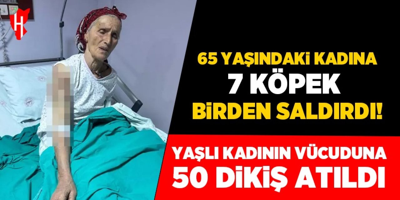 65 yaşındaki kadın köpeklerin saldırısına uğradı: 50 dikiş atıldı!