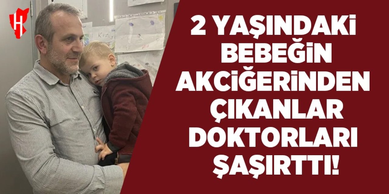 1,5 aydır öksüren bebeğin akciğerinden çıkanlar doktorları şaşırttı!