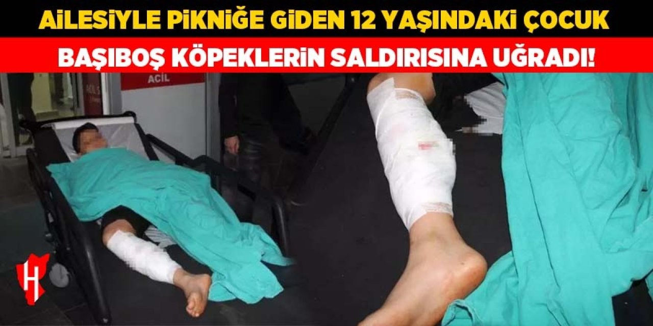 Ailesiyle pikniğe giden çocuk dehşeti yaşadı: Başıboş köpeklerin saldırısına uğradı!