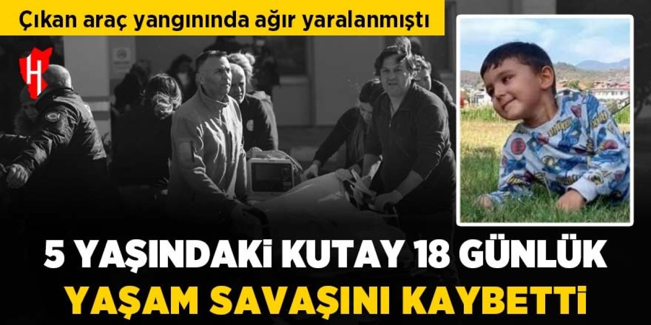 Yangında ağır yaralanan 5 yaşındaki çocuk yaşam savaşını kaybetti