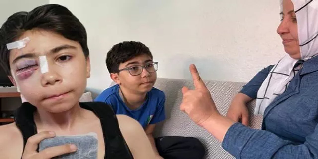 Başına kale direği düşmüştü: 13 yaşındaki çocuk çift görmeye başladı