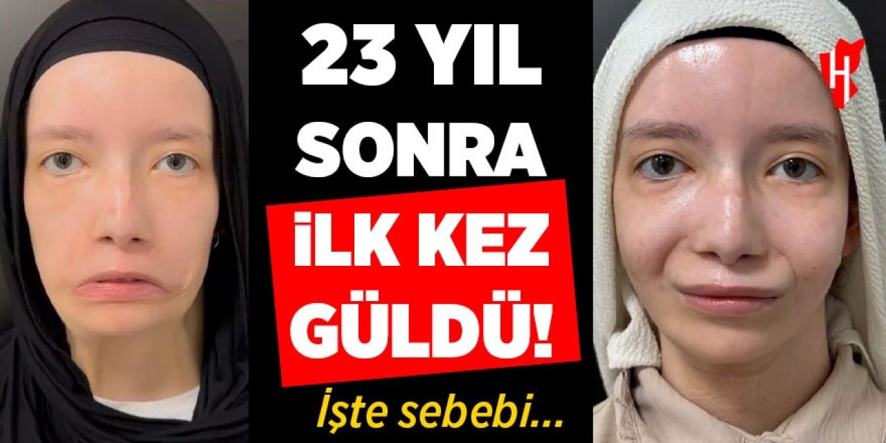 23 yıl sonra ilk kez güldü!