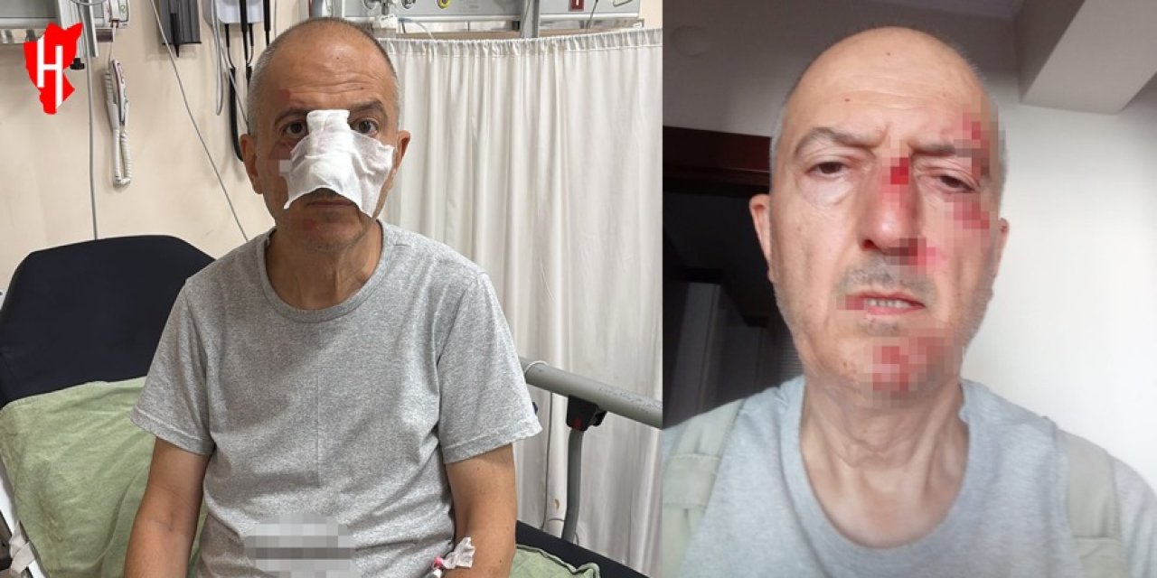 İcra yoluyla evinden tahliye edildi, ardından darp edildi