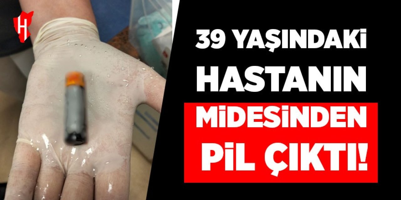 39 yaşındaki hastanın midesinden pil çıktı