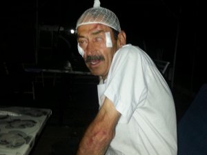 Yaralı Sürücü Karakolda Yaptığı Kazayı Hatırlamadı