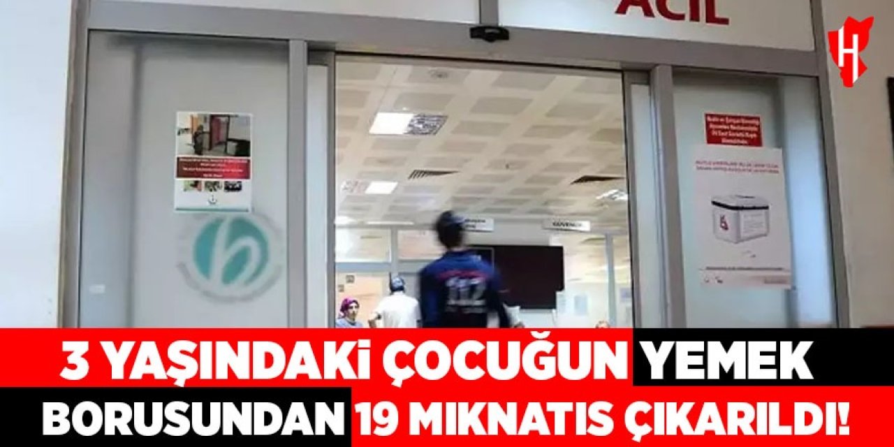 3 yaşındaki çocuğun yemek borusundan 19 mıknatıs çıkarıldı