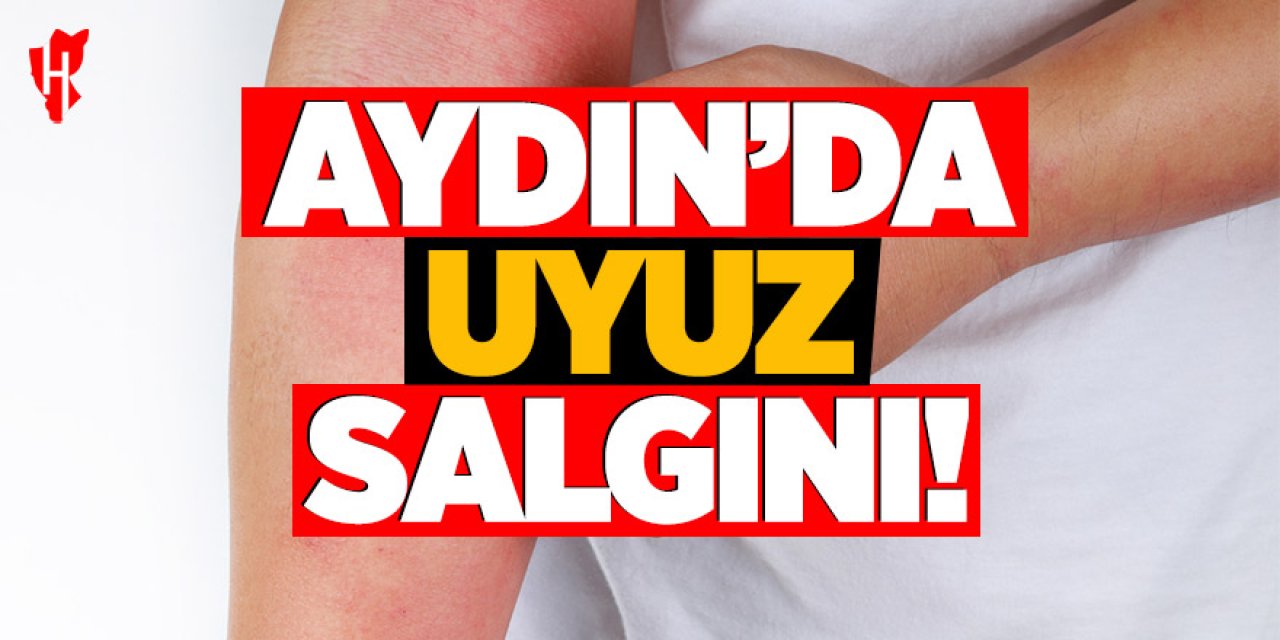 Aydın’da uyuz vakalarında artış! Uzmanlardan hijyen uyarısı