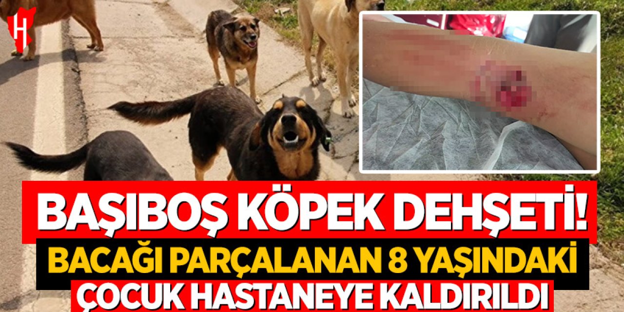Başıboş köpeğinin saldırısı: Bacağı parçalanan 8 yaşındaki çocuk hastaneye kaldırıldı