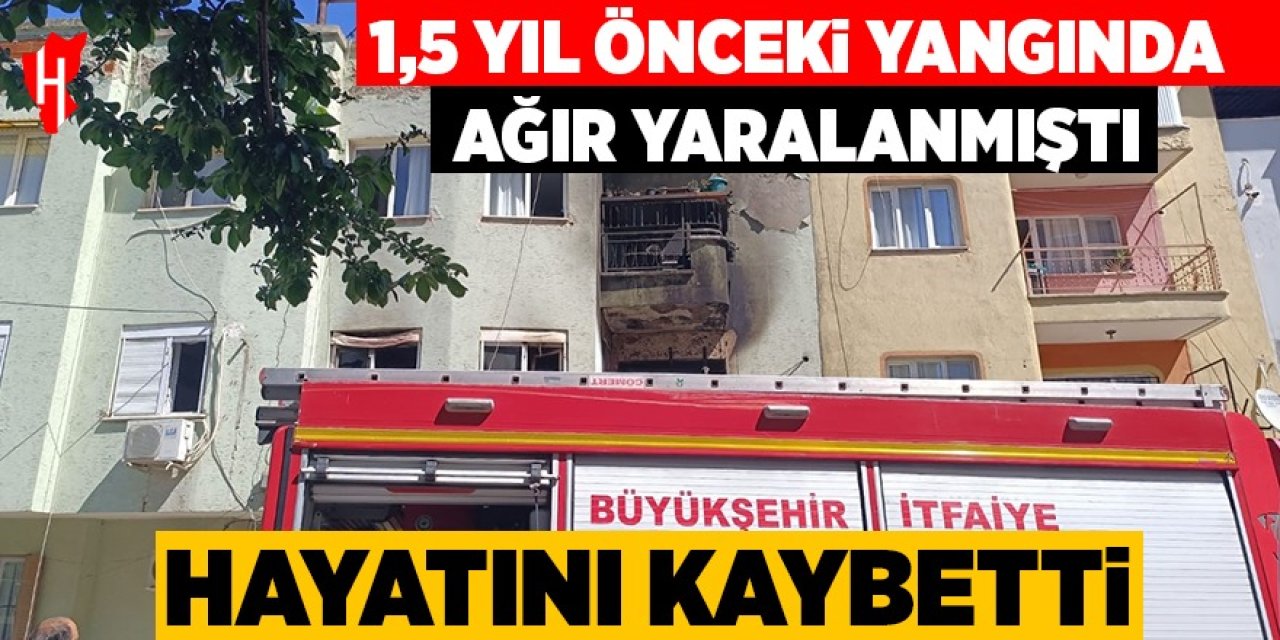 Yangında ağır yaralanan genç kız hayatını kaybetti