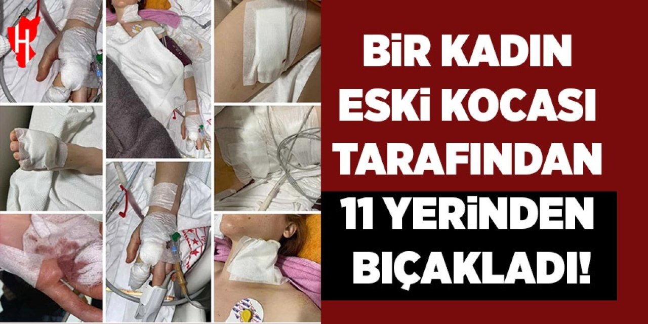 Bir kadın eski kocası tarafından 11 yerinden bıçaklandı