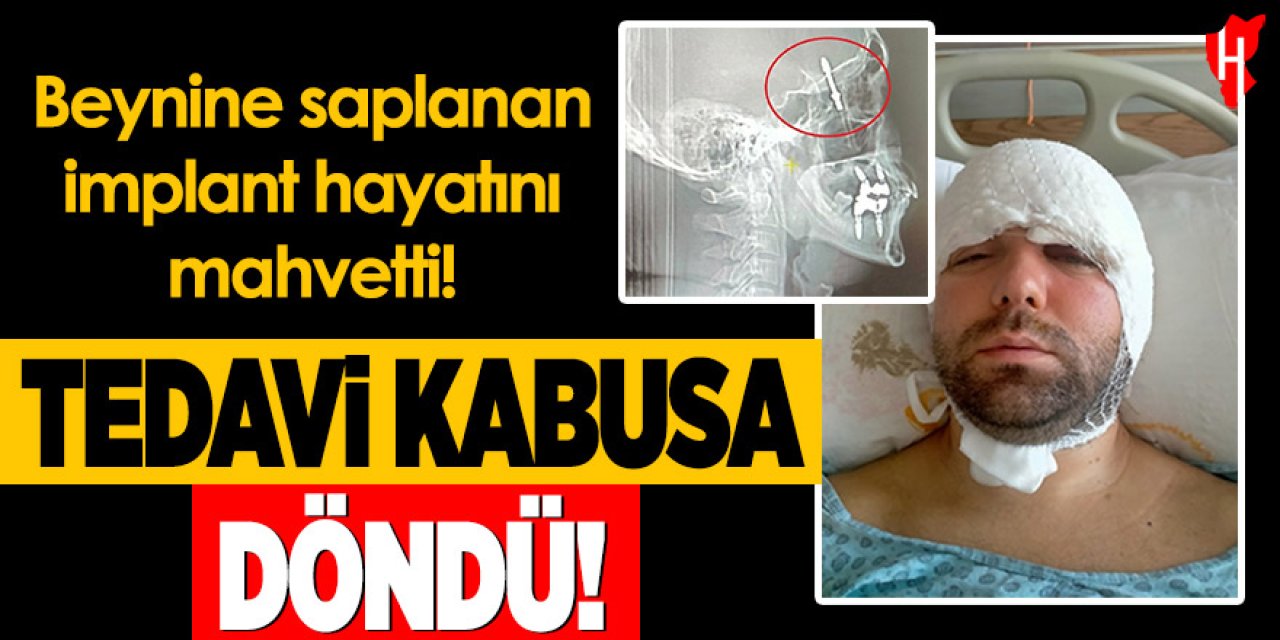 İmplant tedavisi kabusa döndü: Vida beynine saplandı