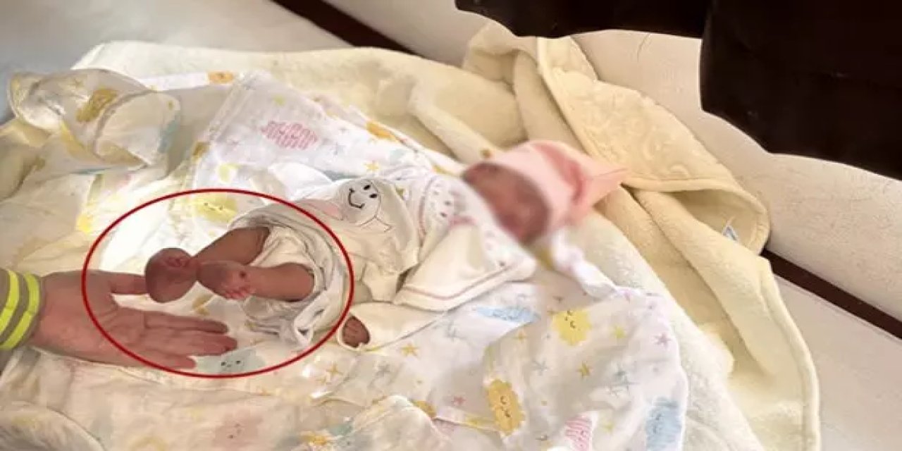Elsiz ve ayaksız doğacaktı! Anne karnında müdahale edildi