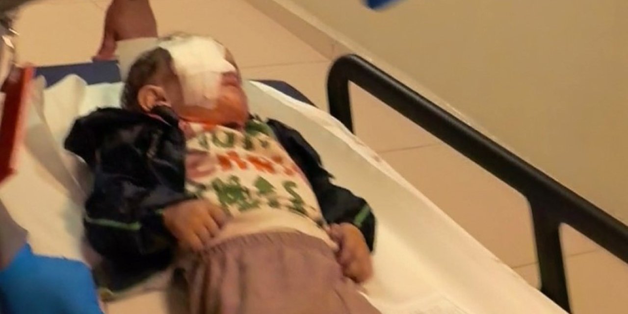 Torpil faciasında 2 yaşındaki çocuk ağır yaralandı