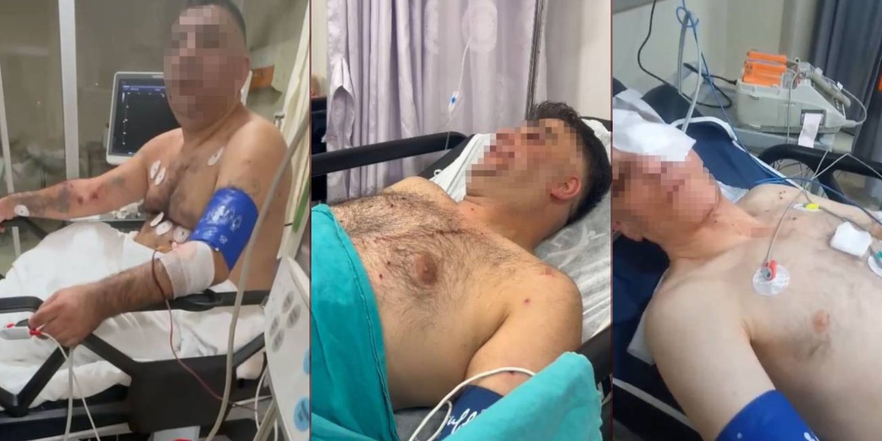 Pompalı tüfekle çevreye ateş eden şahıs, 1’i polis 4 kişiyi yaraladı