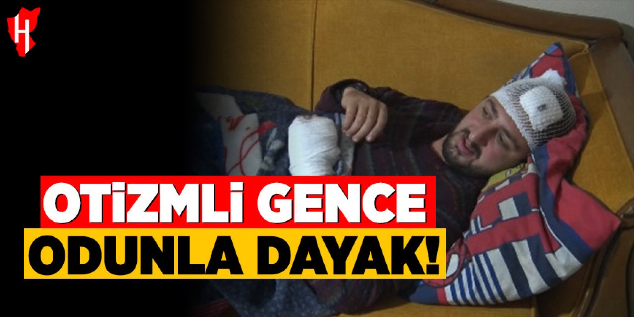 Utanç veren saldırı: Otizmli genç odunla dövüldü!