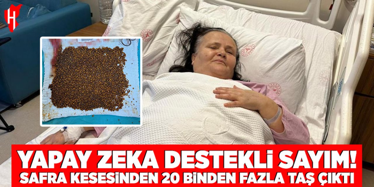 İnanılmaz vaka! 20 binin üzerinde taş çıktı: Doktorlar rekor dedi