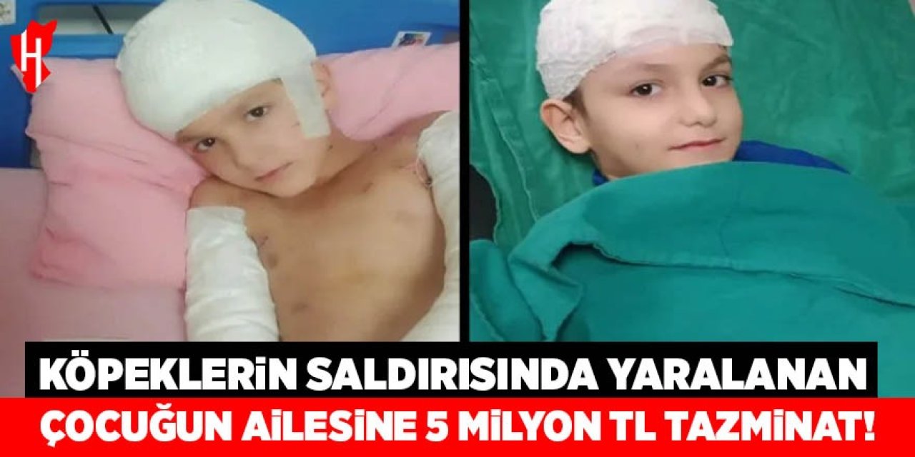 Köpeklerin saldırısında yaralanan çocuğun ailesine 5 milyon lira tazminat!