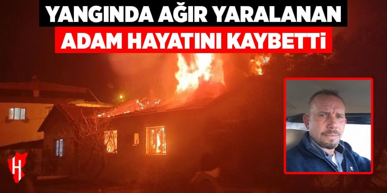 Yangında ağır yaralanan adam hayatını kaybetti