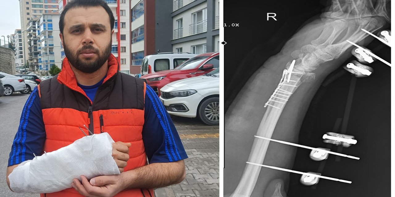 Sahipsiz köpeklerin saldırısından kaçmak isterken bileği kırıldı