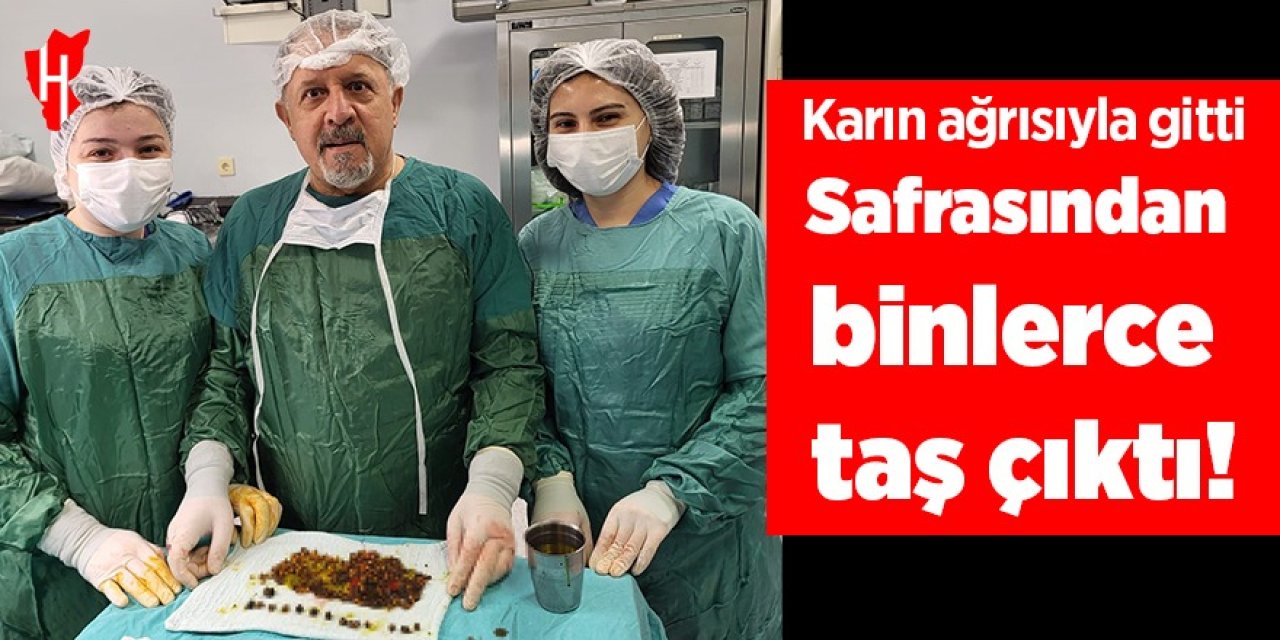 Karın ağrısıyla gitti, safrasından binlerce taş çıktı