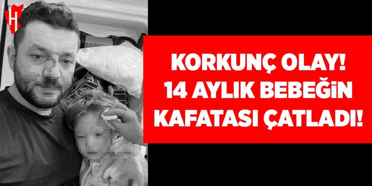 Korkunç olay! 14 aylık bebeğin kafatası çatladı!