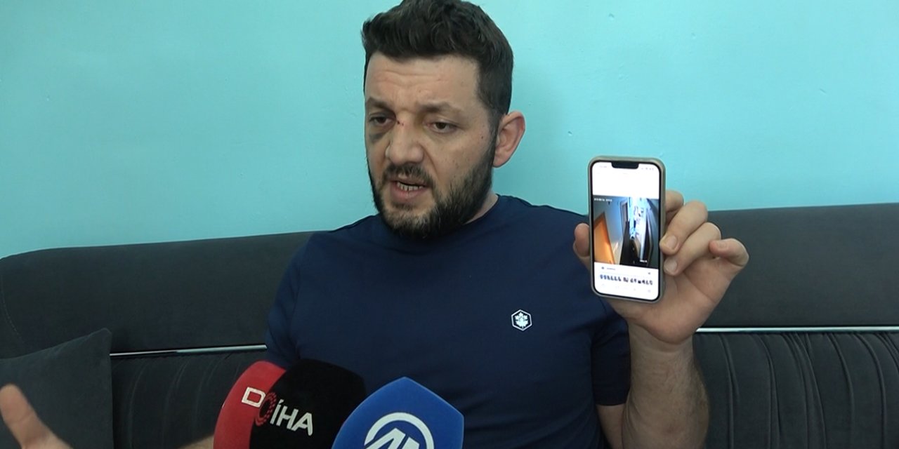 Baba ve 14 aylık kızına scotter ile saldıran zanlının 36 yıla kadar hapsi istendi