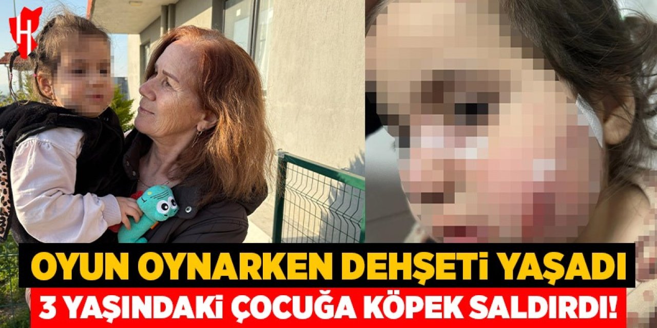 Oyun oynarken dehşeti yaşadı: 3 yaşındaki Ada'ya iki köpek saldırdı
