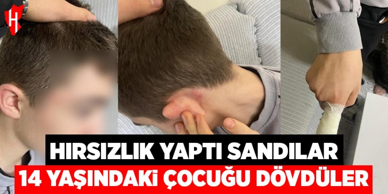 Hırsızlık yaptı sandılar, 14 yaşındaki çocuğu tekme tokat dövdüler