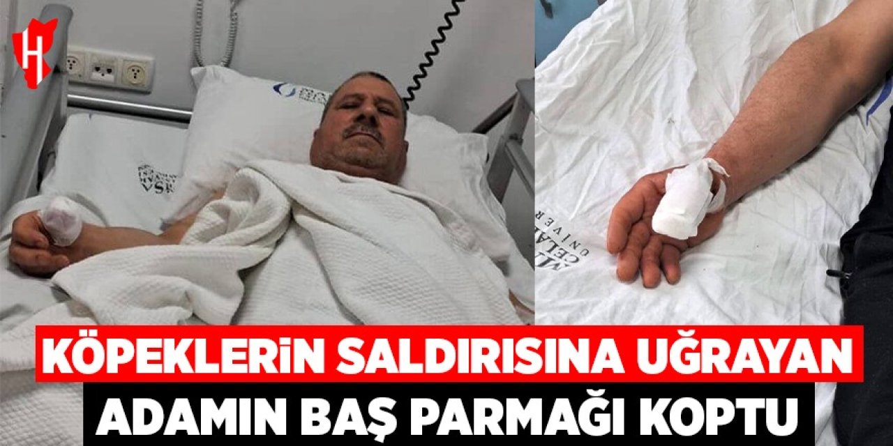 Başıboş köpeklerin saldırısına uğrayan adamın baş parmağı koptu