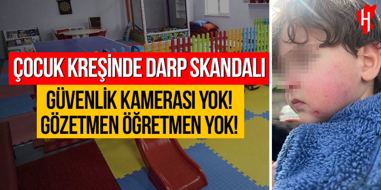 Çocuk kreşinde darp skandalı: 2,5 yaşındaki çocuk darp edildi