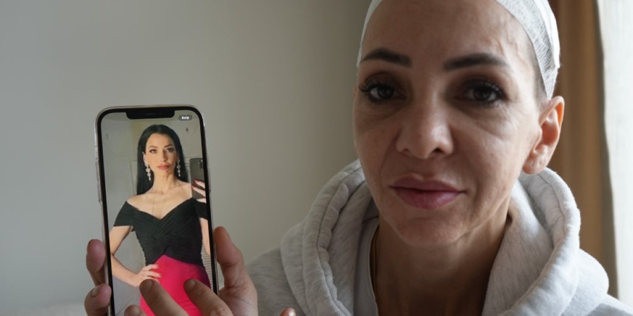 Anne ve oğlunu öldüresiye darp eden şüpheliler: "Merdivenlerden düştü"