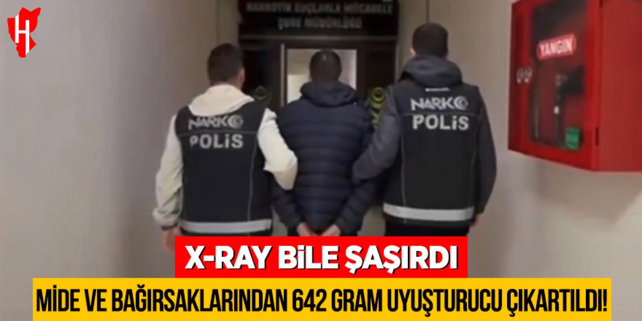 X-ray bile şaşırdı: Mide ve bağırsaklarından 642 gram uyuşturucu çıkartıldı