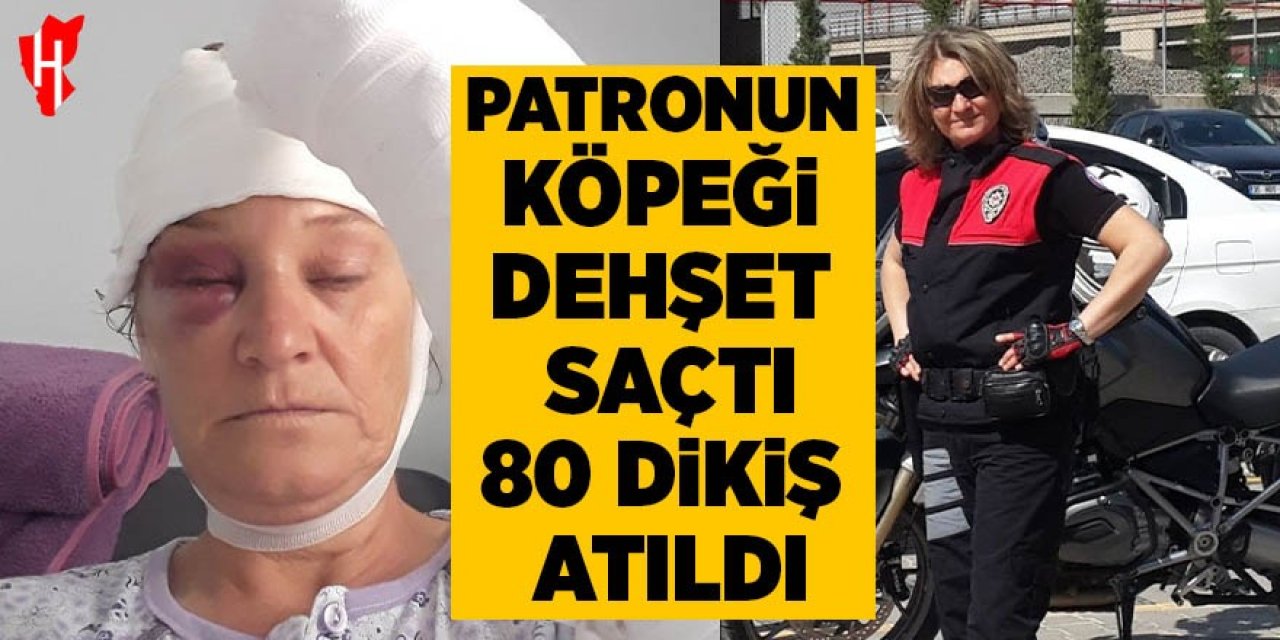 Patronun köpeği dehşet saçtı: Vücuduna 80 dikiş atıldı